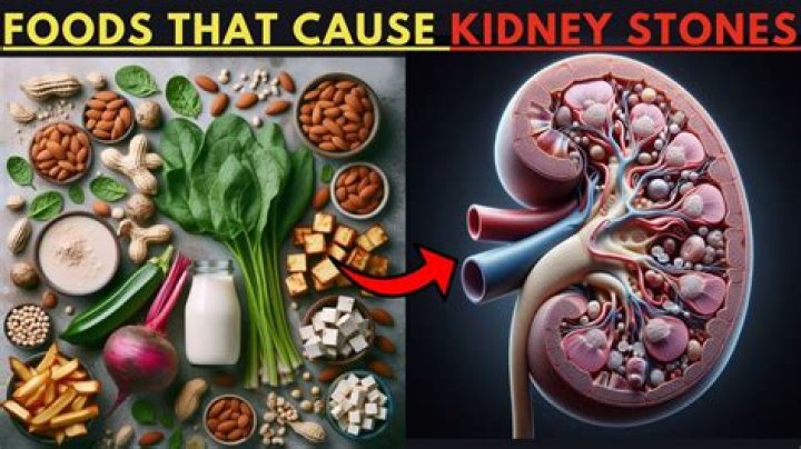 Are Cheerios good for kidney stones?