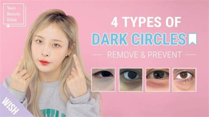 Are dark circles common?