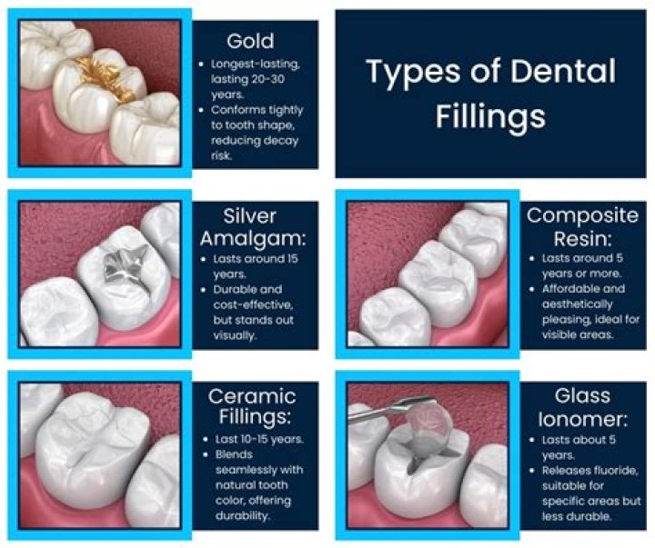 Are gold fillings better?
