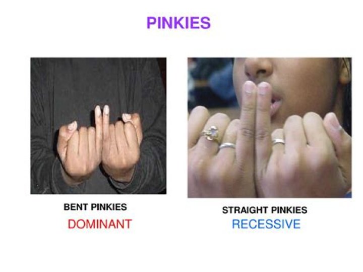 Are pinkies supposed to be straight?