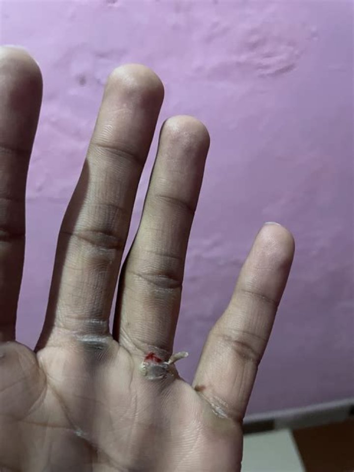 Are pull-ups worth it?