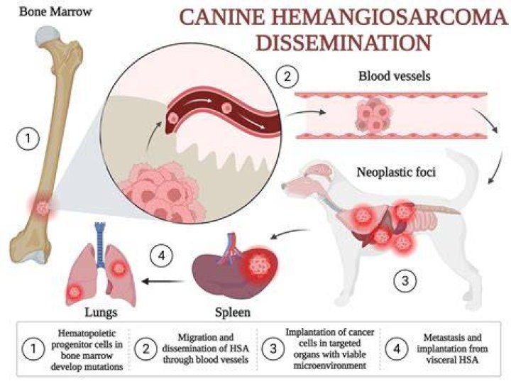 Are sarcomas soft or hard to touch?