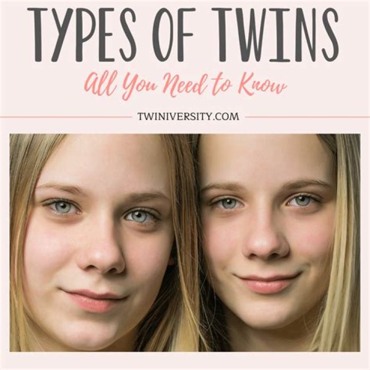 Are twins rare in Japan?
