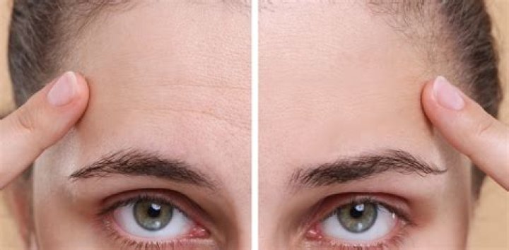 At what age does skin start to wrinkle?