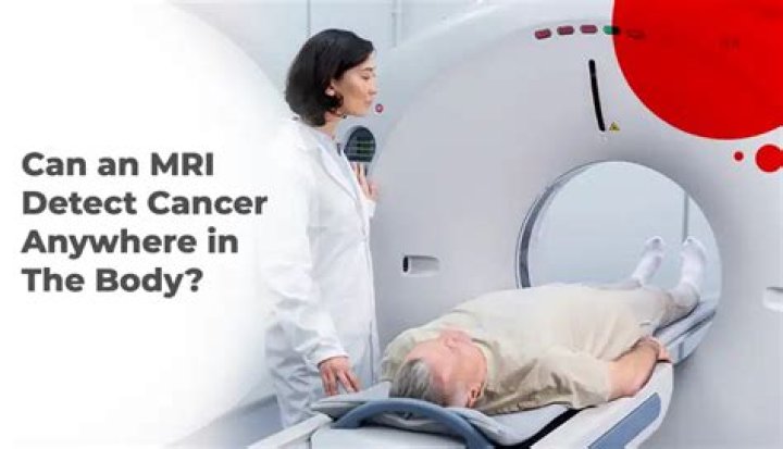 Can a full body MRI detect all cancers?