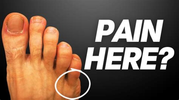Can a stubbed toe hurt for days?