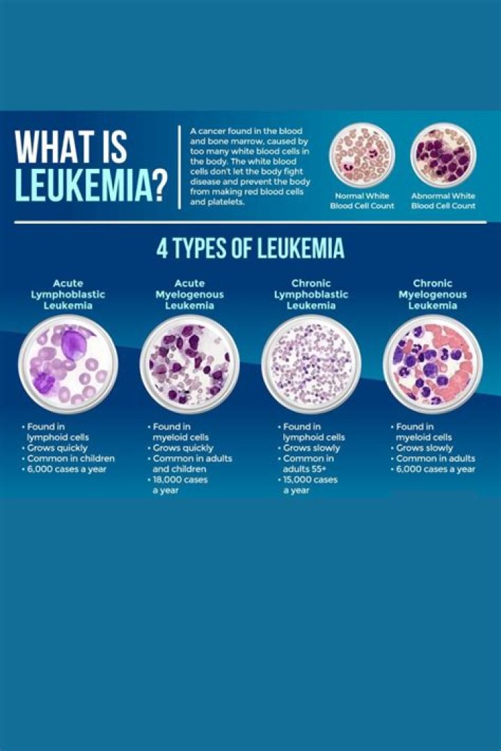 Can all leukemia be cured?