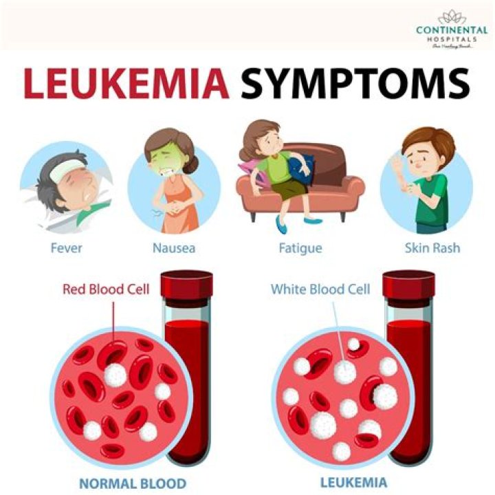 Can an eye exam detect leukemia?