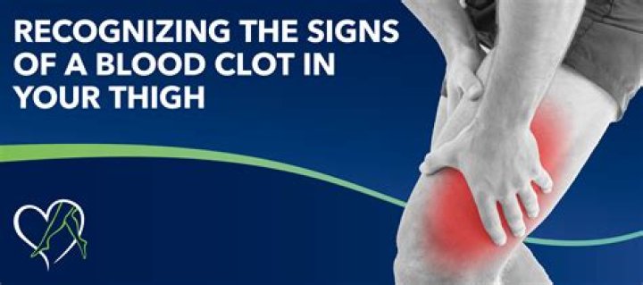 Can aspirin help blood clot in leg?