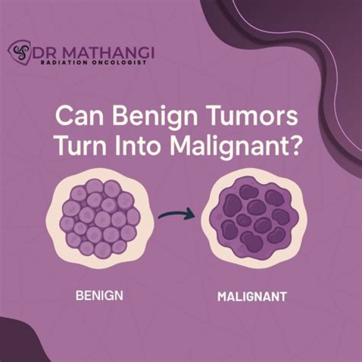 Can benign cysts turn cancerous?