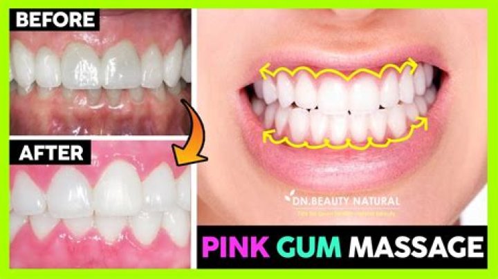 Can black gums become pink again?
