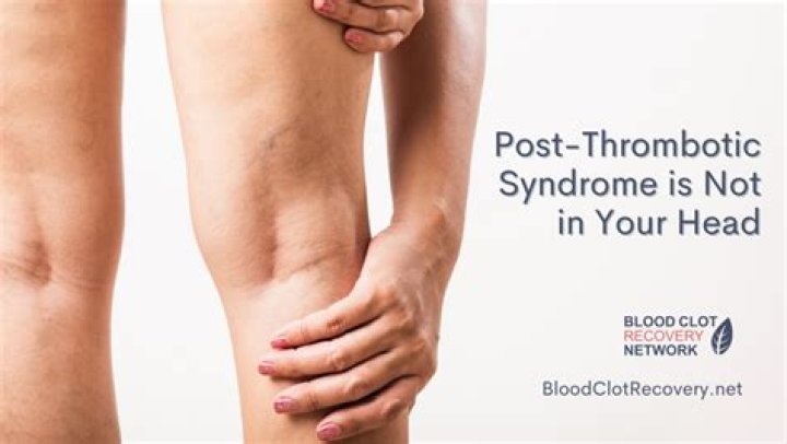 Can blood thinners cause joint problems?