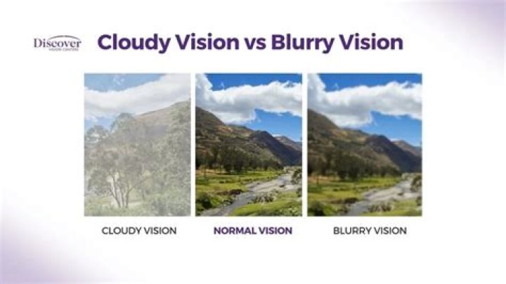 Can blurry vision be cured naturally?