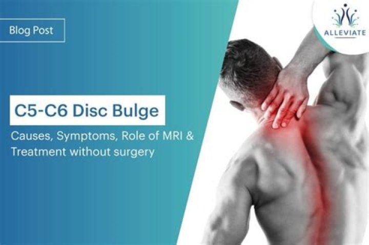Can C5-C6 cause upper back pain?