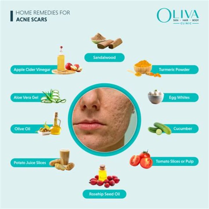 Can eggs help acne?