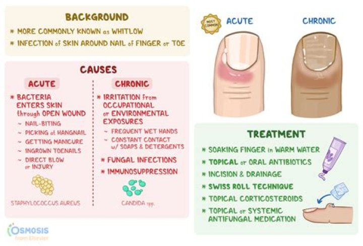 Can fingers cause ear infection?