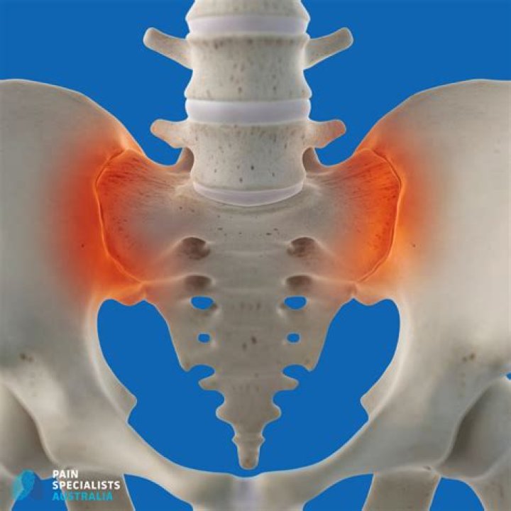 Can hip arthritis mimic sciatica?