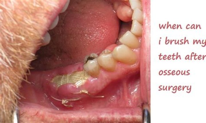 Can I brush my teeth with a tongue piercing?