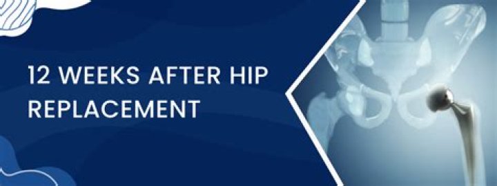 Can I go back to work 2 weeks after hip replacement?