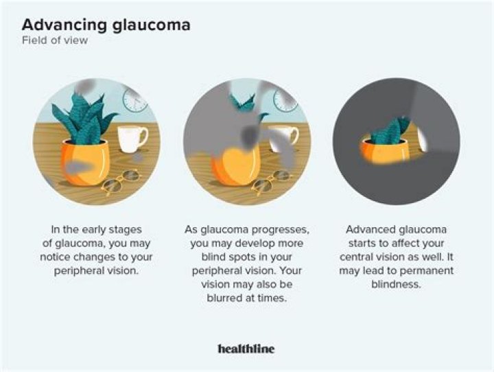Can I use Visine if I have glaucoma?