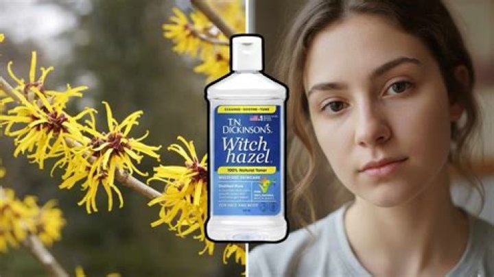 Can I use witch hazel for rubbing alcohol?