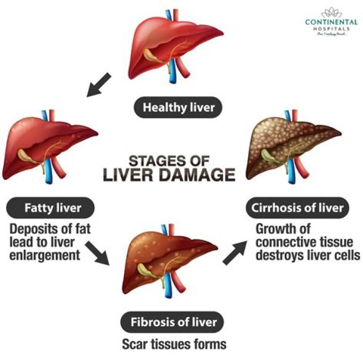 Can liver damage make you gain weight?