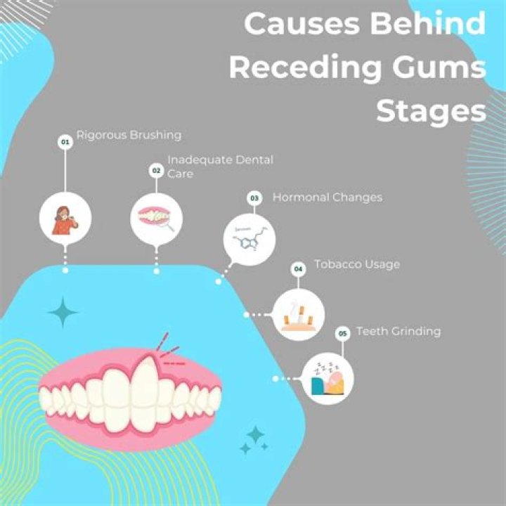 Can receding gums move back?