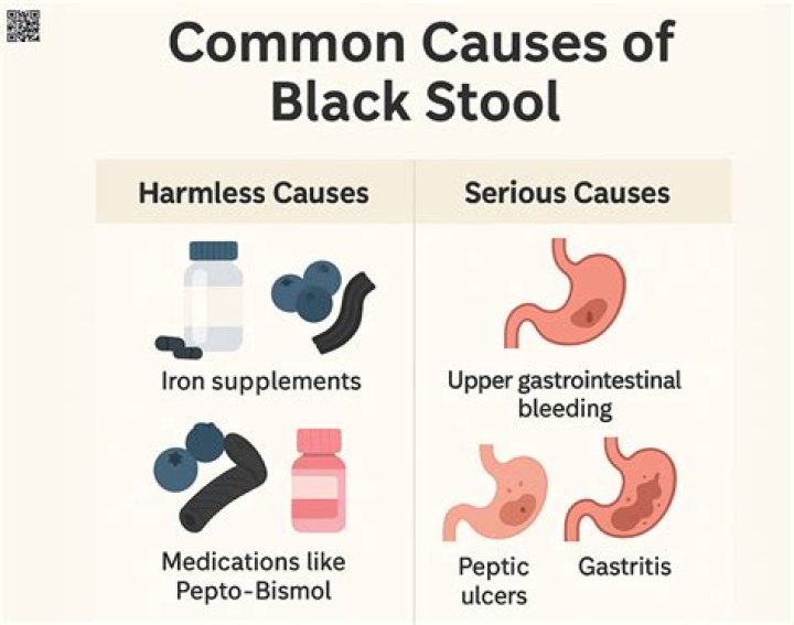 Can stress cause black stool?