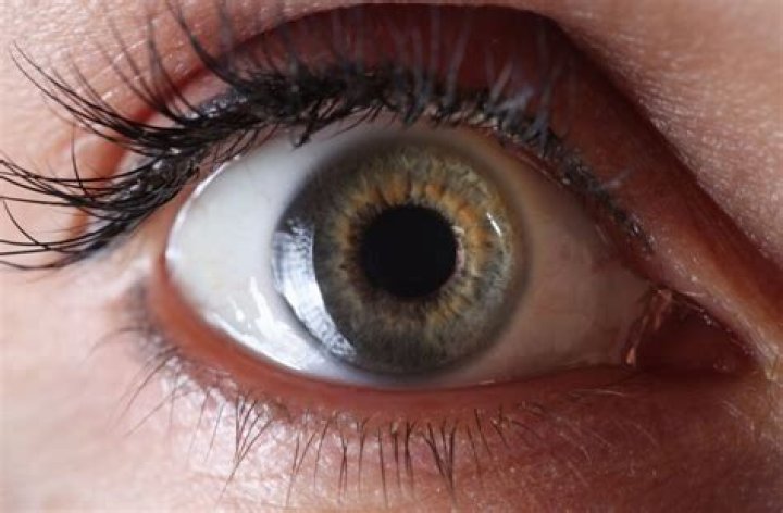 Can stress cause retinal detachment?
