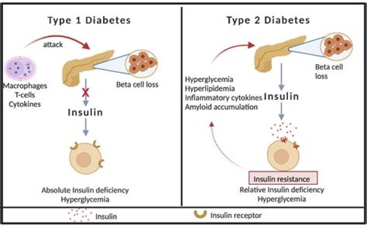 Can type 1 diabetes live without insulin?