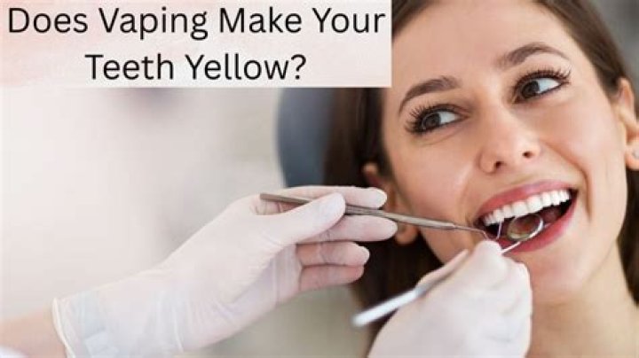 Can vaping make your teeth yellow?
