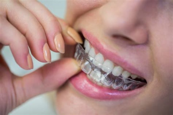 Can you bite with front teeth with braces?