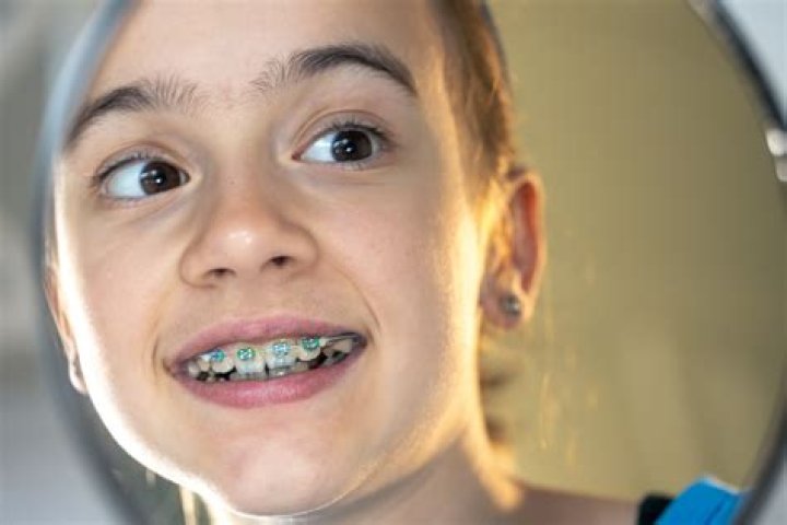 Can you drink water with wax on your braces?