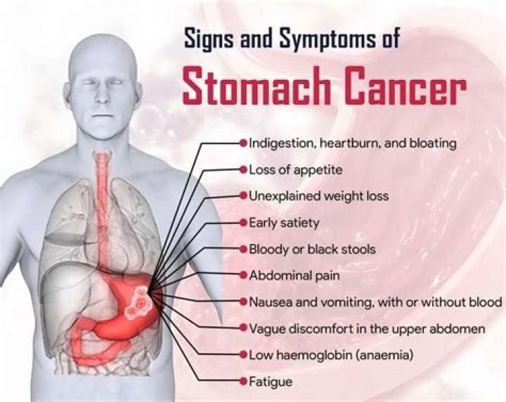 Can you feel a stomach tumor?