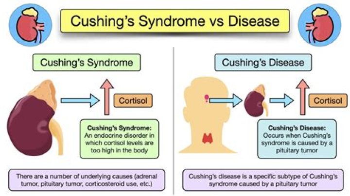 Can you get Cushings from stress?