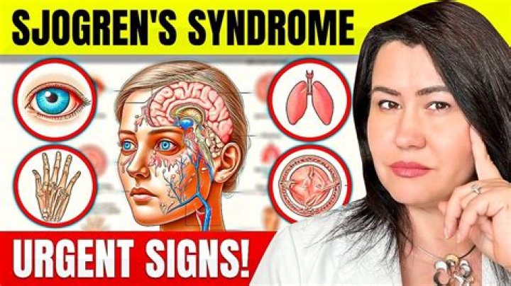 Can you get disability for Sjogren's syndrome?