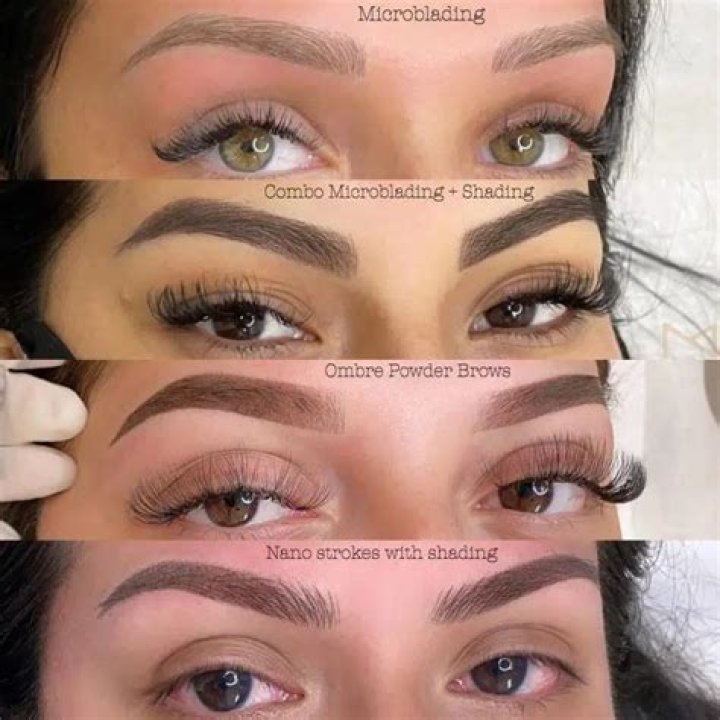 Can you get Microblading If you have vitiligo?