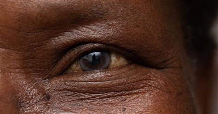 Can you go blind from crying too much?