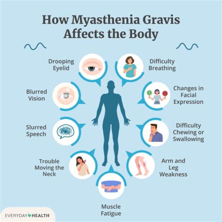 Can you have myasthenia gravis and not know it?
