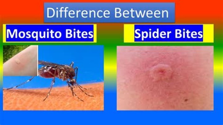 Can you pop a mosquito bite?