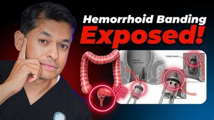 Can you put ice directly on hemorrhoid?