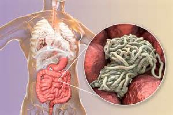 Can you see pinworms on toilet paper?