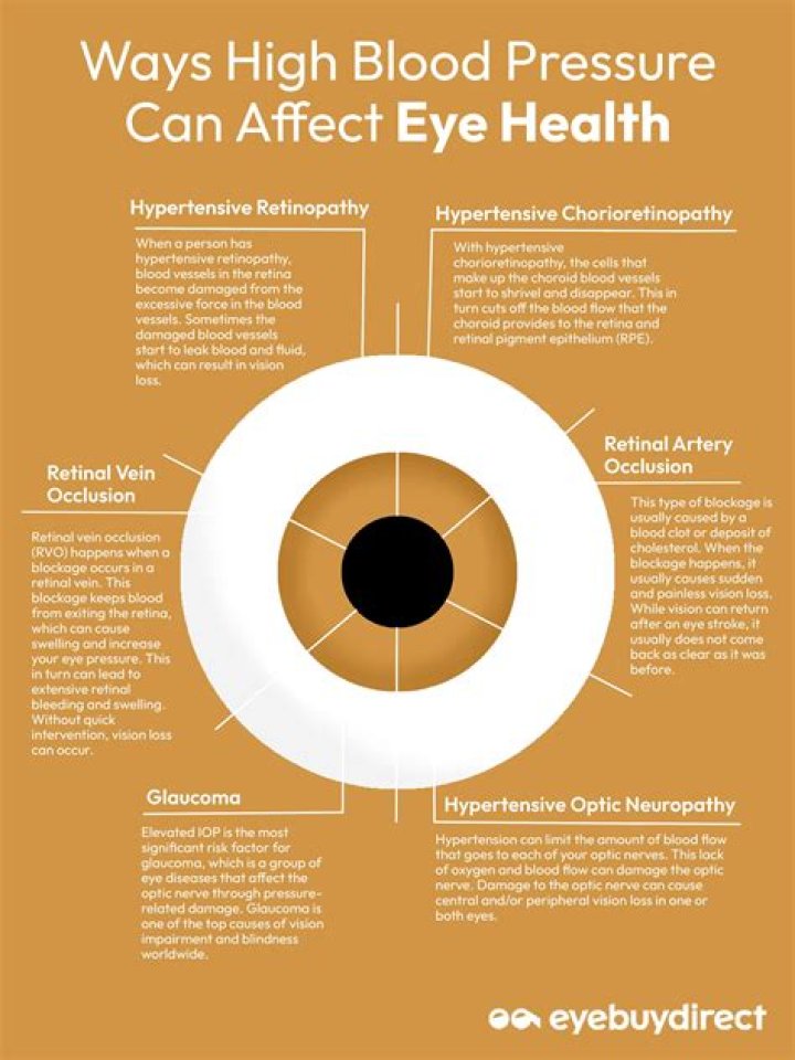 Can you tell if you have high blood pressure by your eyes?