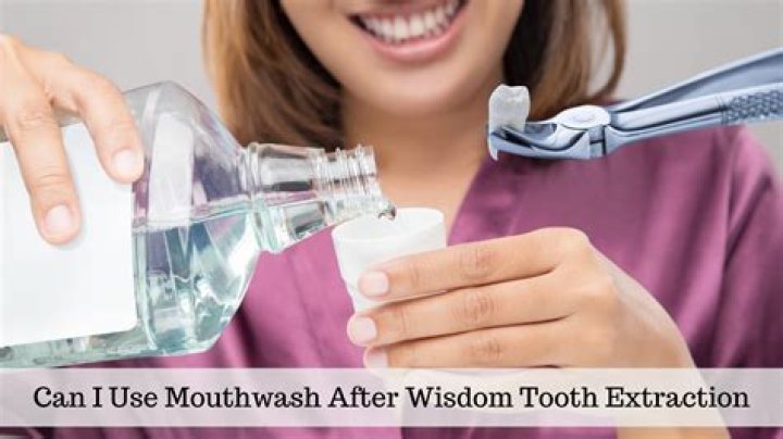 Can you use mouthwash when you have oral thrush?