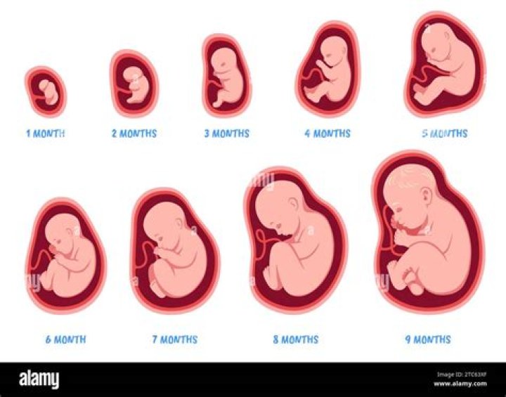 Do babies grow hair in the womb and eat it?