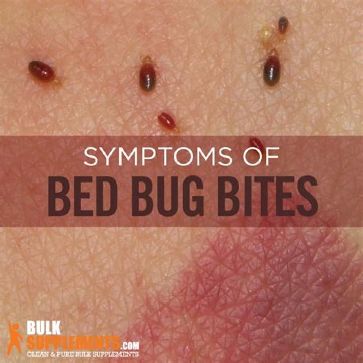 Do bed bug bites itch?