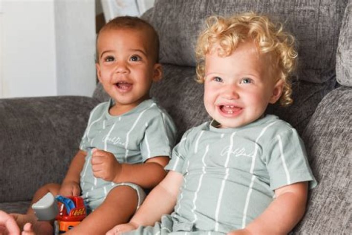 Do biracial twins exist?