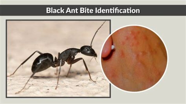 Do black ants bite you?