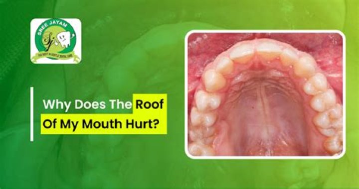 Do dentures cover the roof of your mouth?