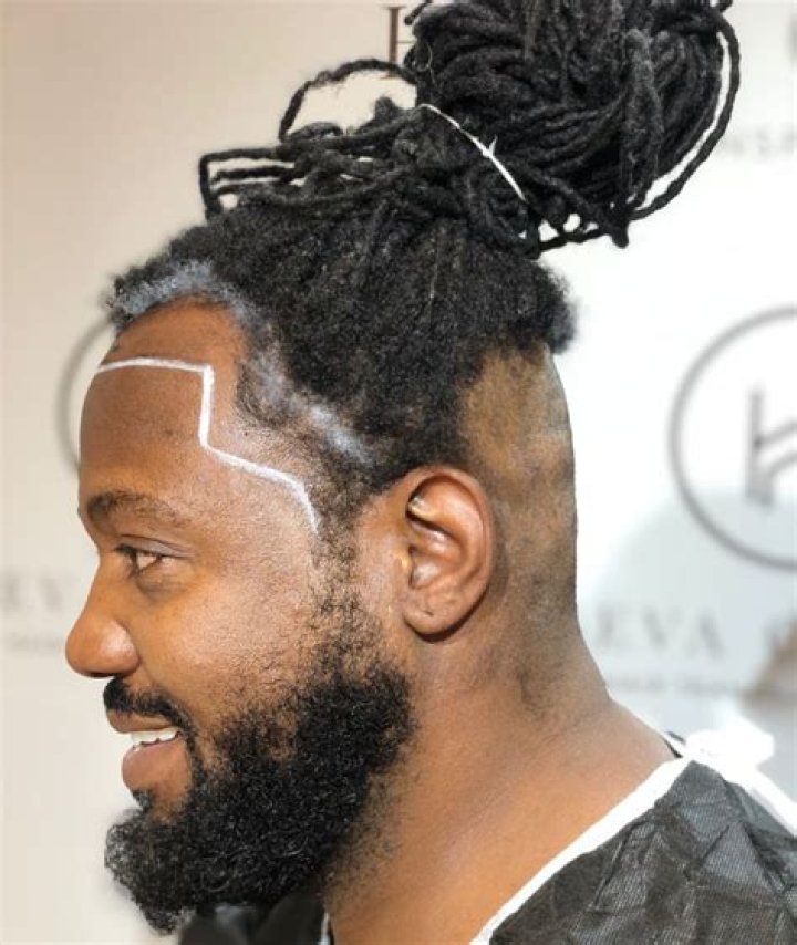 Do dreads make you go bald?